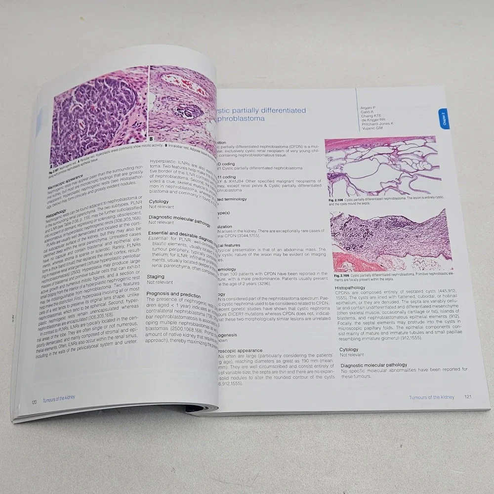 WHO Classification of Tumours 5th Ed. Urinary and Male Genital Tumours Paperback